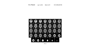 Cool AI Patents: AI Increases Focus in Video Calls & Identifies Immediate Surgical Intervention Case