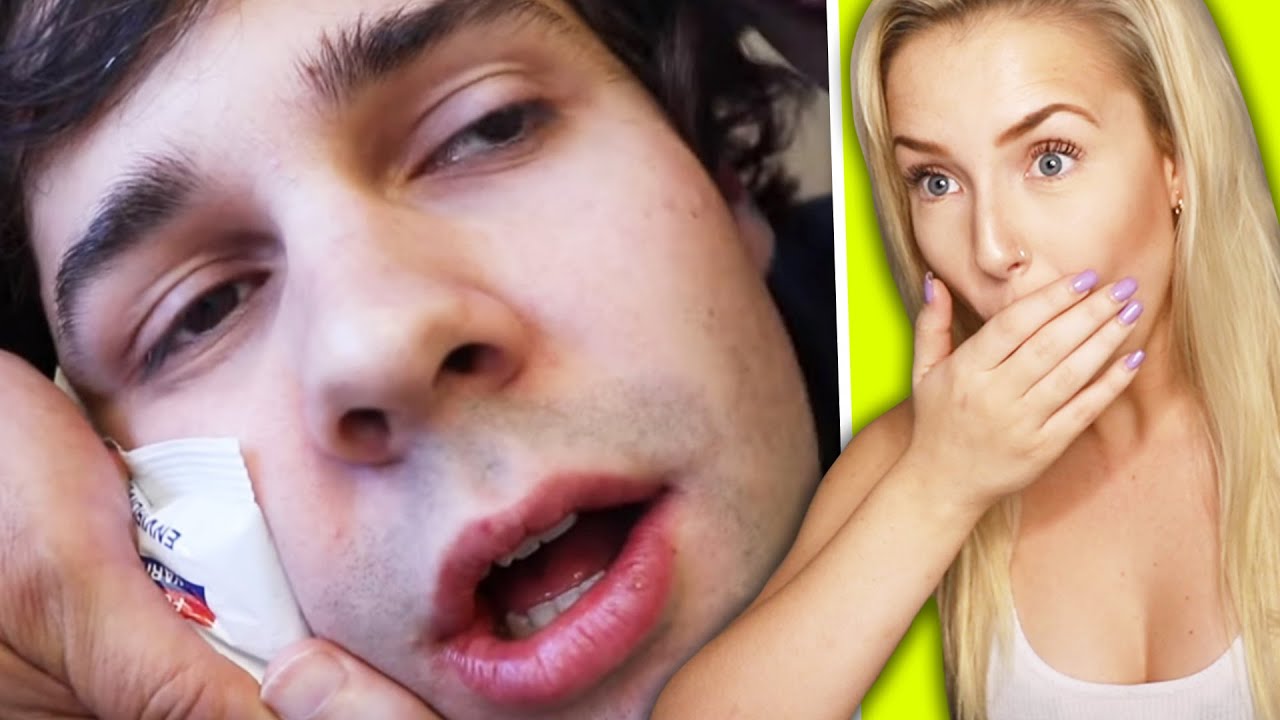 HILARIOUS Wisdom Teeth REMOVALS! - YouTube