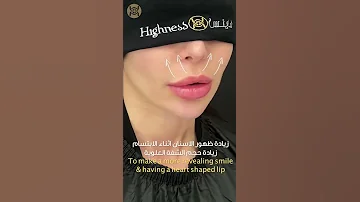 عملية رفع الشفة مع الدكتور فراس حمدان 