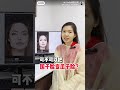 【绑牙】绑牙脸变小?#allsmiledentalspecialist #绑牙 #牙套 #牙醫
