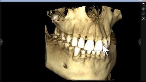 New mRomexis for light image viewing in Planmeca Romexis 4 0