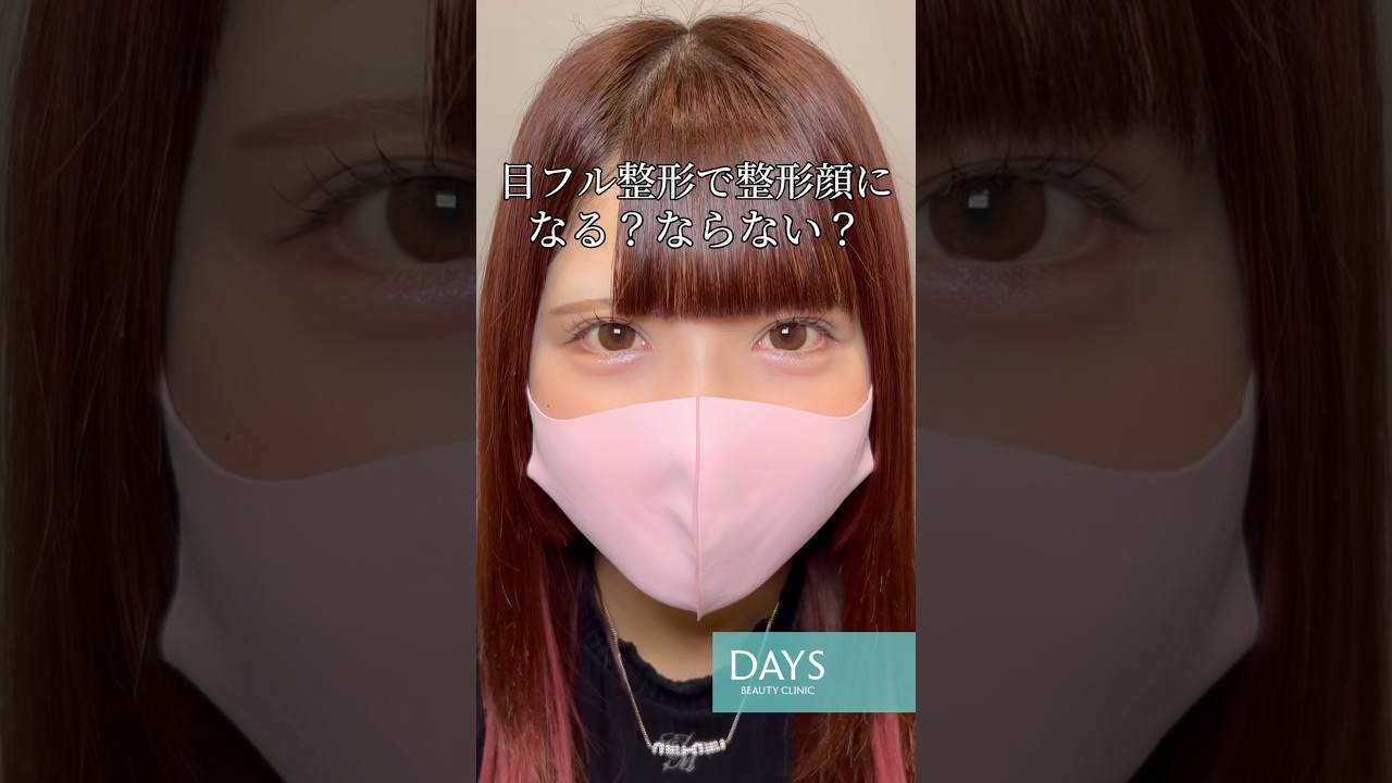【目フル整形】目フル整形で整形顔になる人の特徴#shorts