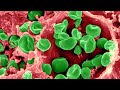 Tularemia Research in NIAID Laboratories