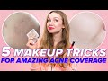 5 Makeup Tricks For Acne (how to cover acne marks and feel comfortable in your skin)