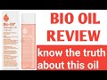 BIO OIL REVIEW/MY HONEST REVIEW/KNOW EVERYTHING ABOUT THIS OIL NOW.