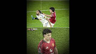 Lisandro Martinez received red card for violent conduct after pulling Dominic Calvert-Lewin's hair.