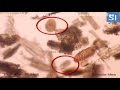 Egg Contains Larva And Fasciola Sp Egg In Feces Of Donkey Egg Contains Larva And Fasciola Sp Egg In Feces Of Donkey