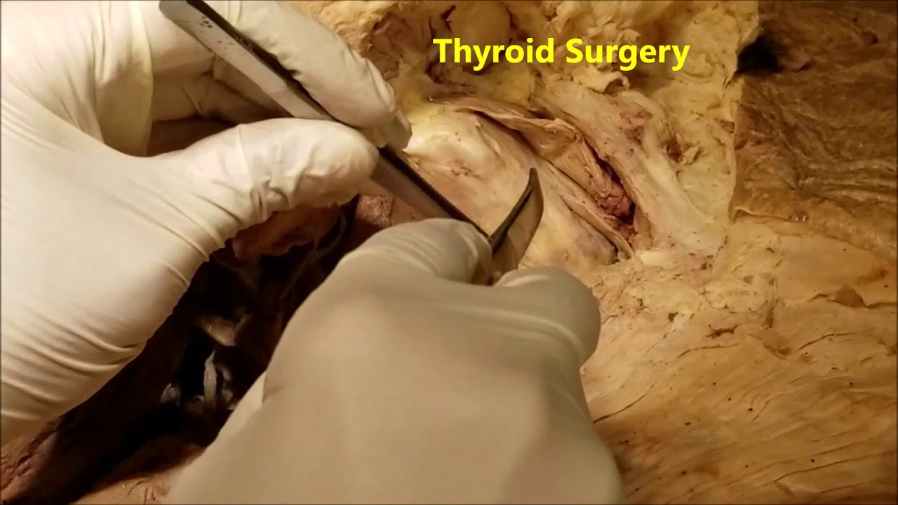 Infrahyoid Muscles And Anterior Jugular Vein With Clinical Aspects Sanjoy Sanyal