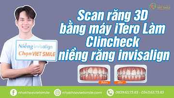 Xem trước kết quả niềng răng với Clincheck invisalign