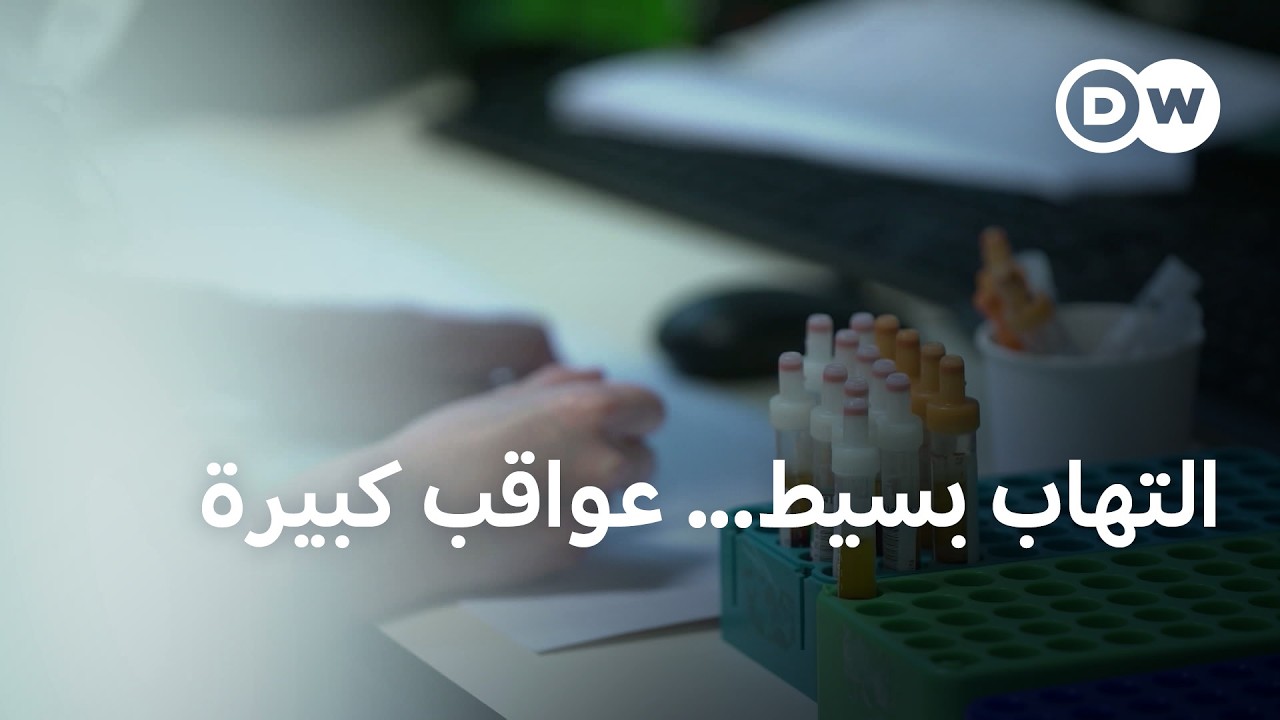 ����� ����� ��������: ��� ���� ��� ���� ������� | ���� ��� ����
 - نشر قبل 9 دقيقة