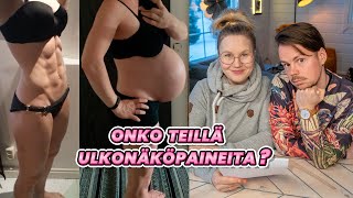 SAITTE KYSYÄ IHAN MITÄ VAAN | Q&A