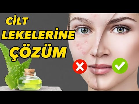 Video: Niasinamid yağlılığa kömək edirmi?