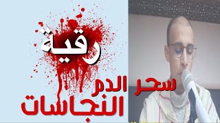 رقية سحر الدم و النجاسات ( السحر الاسود ) الراقي المغربي زهير ادم