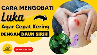 Cara Mengobati Luka kena Knalpot Agar Cepat Kering dan Sembuh dengan Daun Sirih | 100% Efektif