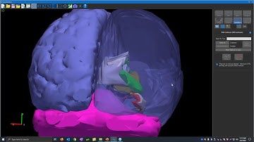 Webinar: Introduction to Neurolucida
