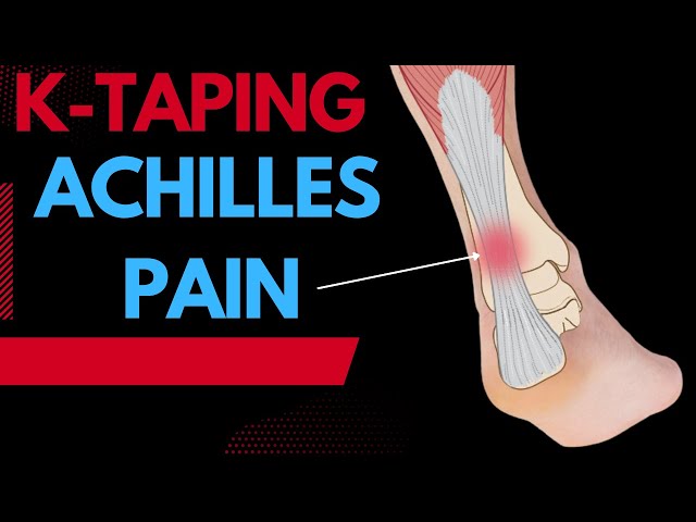 How To Treat Achilles Tendonitis Using Kinesiology Tape Youtube