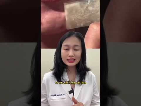 Nên dùng miếng