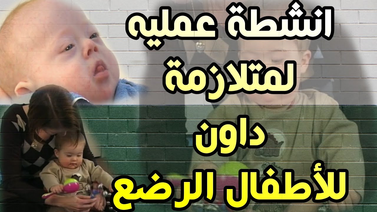 متلازمة داون سببها زيادة في