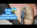 O QUE É ISSO QUE SAIU DESSA UNHA INACREDITÁVEL😵😷 Parte 2