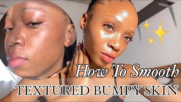 How to Get Rid & Smoothen TEXTURED , BUMPY Skin | #dryskin #acneproneskin  #skincareroutine