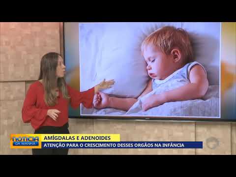 Vídeo: Polydexa Com Adenóides - Indicações, Prós E Contras