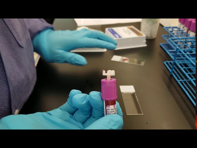Hematology: Making a Peripheral Blood Smear