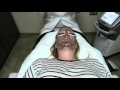 Spectra Laser Facial