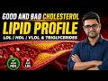 Lipid Profile Test Explained | LDL, HDL, VLDL & Triglycerides Made Simple