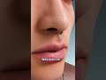 Have you ever wondered why your nosegets stuffy #stuffy #stuffynose #nose 3dmedicalvideo