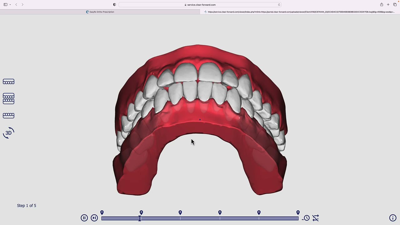 EasyRx Aligner Notification