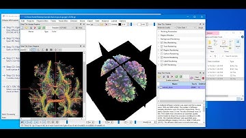 NIFTI file to Tractography in 2 minutes