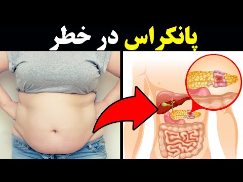 علائم  هشدار دهنده ای که نشان می دهد پانکراس (لوزالمعده) در خطر است ! پانکراتیت و راه های درمان