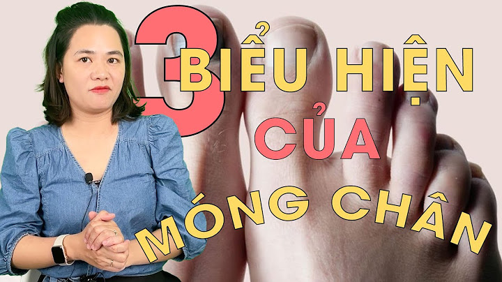 Móng chân bị sần sùi là thiếu chất gì năm 2024