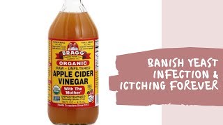Use Apple Cider Vinegar To Banish Itching And Yeast Infection In 3 Days