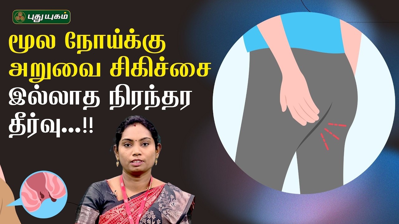 மூல நோய்க்கு அறுவை சிகிச்சை இல்லாத நிரந்தர தீர்வு...!! | Dr. Saranya | 19/02/2026 | #Doctoroncall