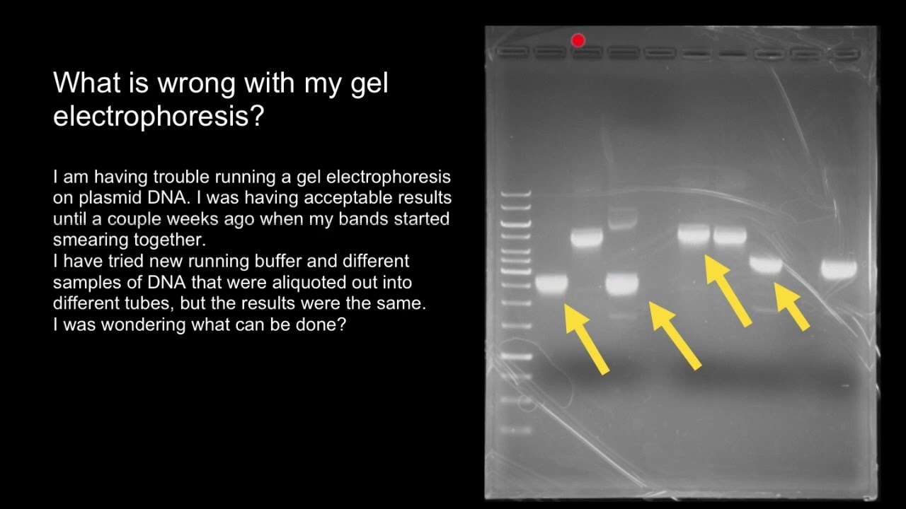 How To Interpret Plasmid DNA Gel Electrophoresis Results YouTube How To Interpret Plasmid DNA Gel Electrophoresis Results YouTube