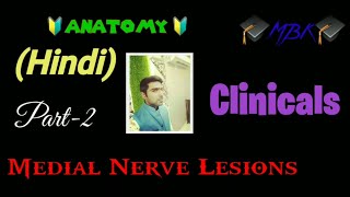 Part-2 Clinical Median Nerve Upper Limb Kvsr Medico Mbbs