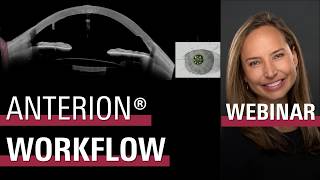 Beyond Imaging Elevate Your Anterior Segment Workflow U S