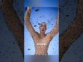 The Science Behind Mosquito Bites