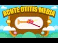 What is Acute Otitis Media?