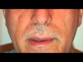 Time lapse moustache growth