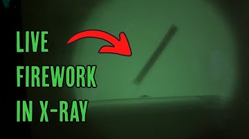 Fluoroscopy - Real time X-ray vision