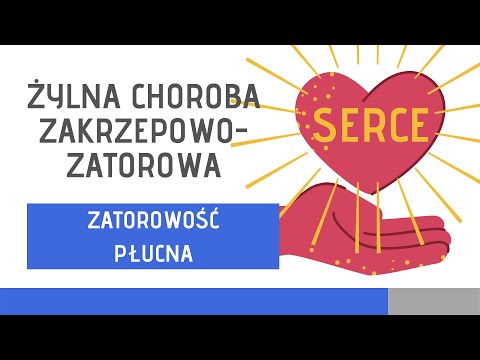 Wideo: Zatorowość Płucna - Objawy, Leczenie Zatorowości Płucnej