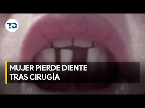 Mujer pierde diente