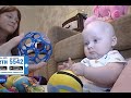 Олег Диев, 5 месяцев, деформация черепа, требуется лечение специальными шлемами-ортезами