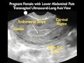 Ectopic Pregnancy Case Study - Part 1