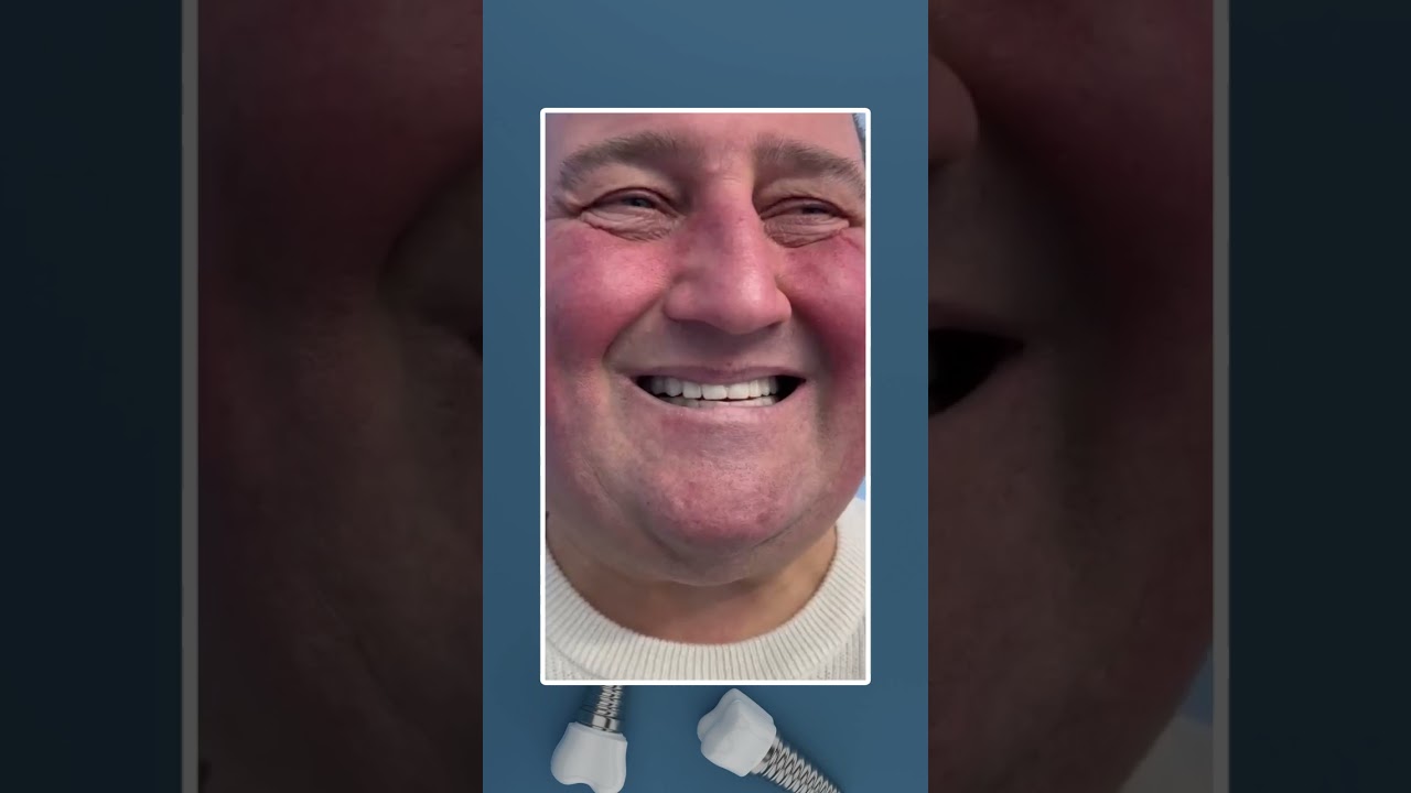 Zambet complet chiar si cu boala parodontala avansata!