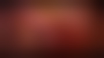 Laparoscopic Appendectomy with voice over | Dr. Pranay Gourav | Advanced Lap and GI Surgeon