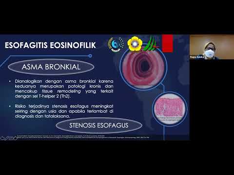 Video: 4 Cara Mudah Mencegah Eosinofilik Esofagitis