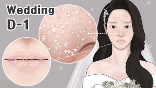 ASMR 결혼식 전날! 여드름, 블랙헤드, 입술 각질 제거 피부관리 애니메이션! LULUPANG
